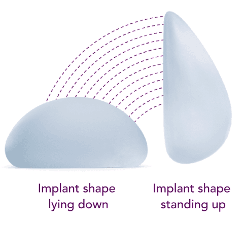 Motiva SmoothSilk® Ergonomix® breast implant illustration