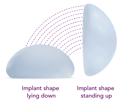 Motiva SmoothSilk® Round breast implants illustration